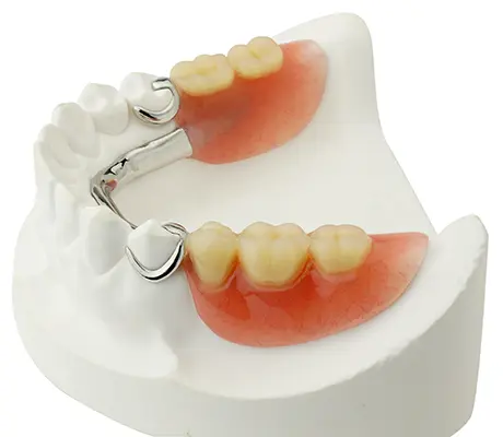 Partial Dentures